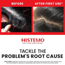 A promotional before-and-after graphic for Histemo anti-hair loss system. The top half shows a red banner with the words BEFORE and AFTER FIRST USE, with two close-up hair scalp photos demonstrating hair density.